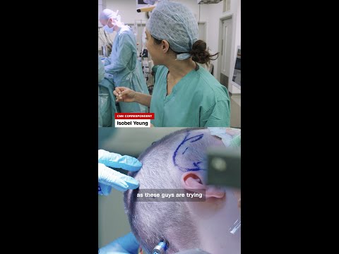 28-year-old man donates part of his brain for research