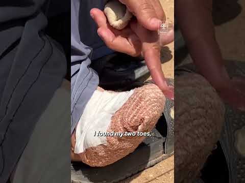 Palestinians report rodent infestation across Gaza City