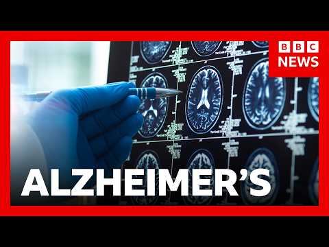 ‘Breakthrough’ Alzheimer’s drugs unlikely to benefit patients, report suggests | BBC News