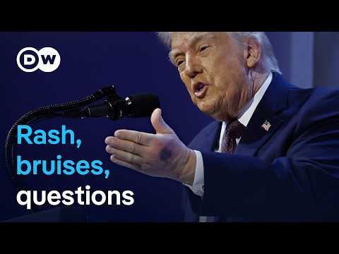 Trump says he’s healthy amid new questions over recent images | DW News