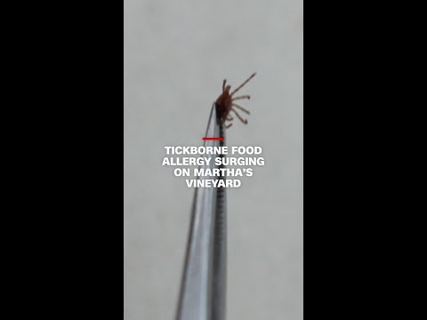 Tickborne food allergy surging on Martha’s Vineyard