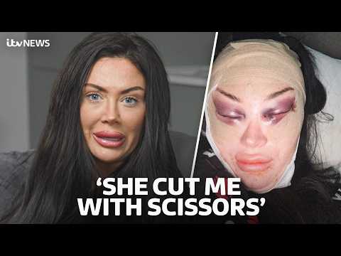 The shocking cosmetic surgery carried out in someone’s bedroom