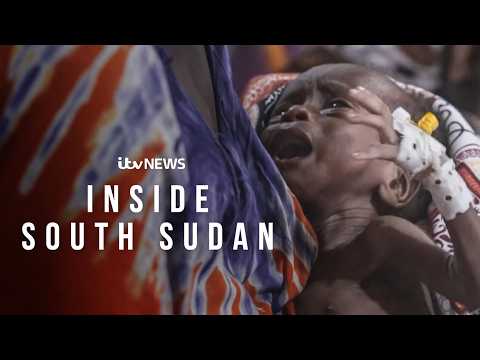 We witness ‘devastating’ malnutrition on the ground in South Sudan