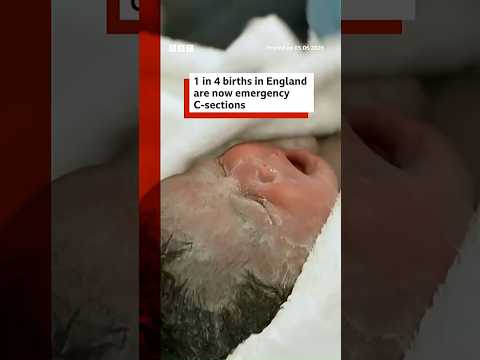 One in four births in England are now emergency caesareans, BBC analysis shows. #BBCNews