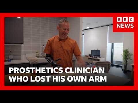 ‘I worked with prosthetic limbs, then I lost my arm’ | BBC News