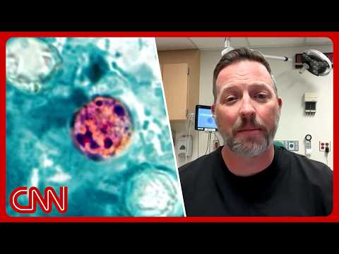 Diarrhea parasite: This food may be the source of Cyclospora