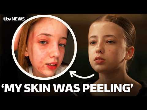 Alarm at children as young as four using anti-ageing skin treatments