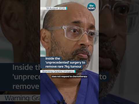 Inside the ‘unprecedented’ surgery to remove rare 7kg tumour