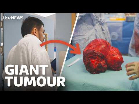 Watch surgeons remove 7kg tumour the size of a bowling ball from man’s neck