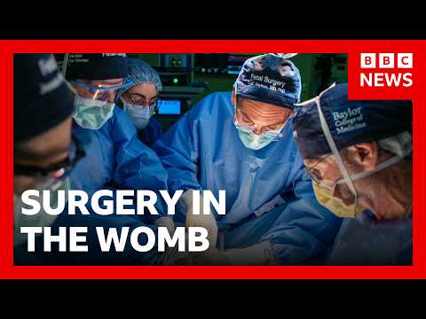 Pioneering womb surgery for ‘miracle’ baby with intestines outside its body | BBC News