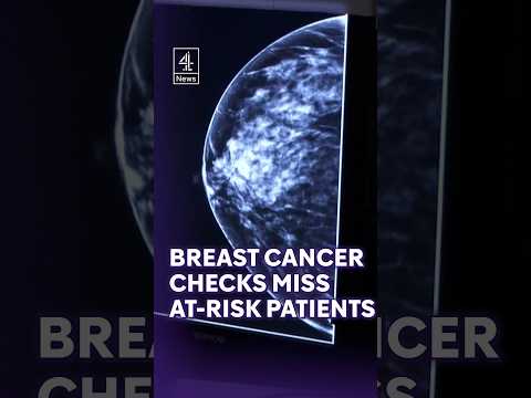 Most women at risk of breast cancer under 50 are not being referred, says study #NHS #Health