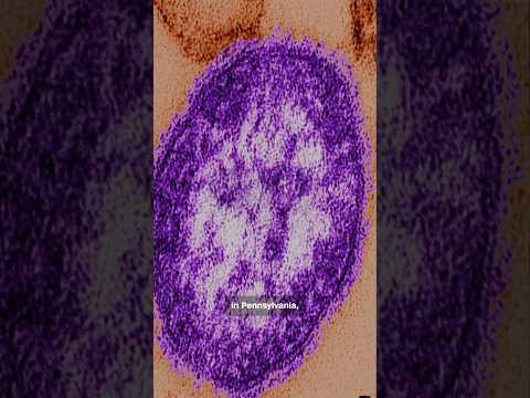 Unvaccinated woman is third measles-related death in Pennsylvania