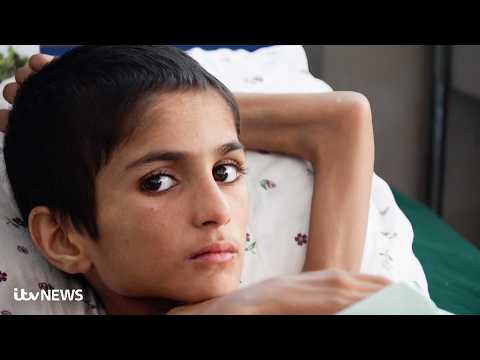 Heartbreaking pictures show ‘malnutrition epidemic’ facing Afghanistan’s children