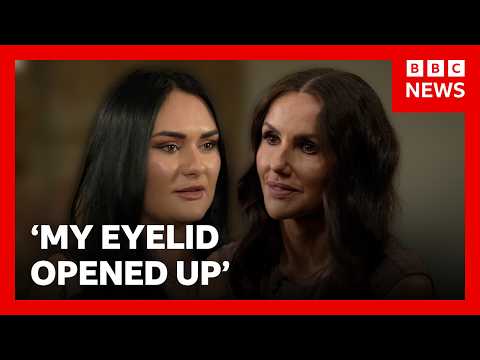 Warnings from women over cheap ‘bleph’ eyelid surgery | BBC News