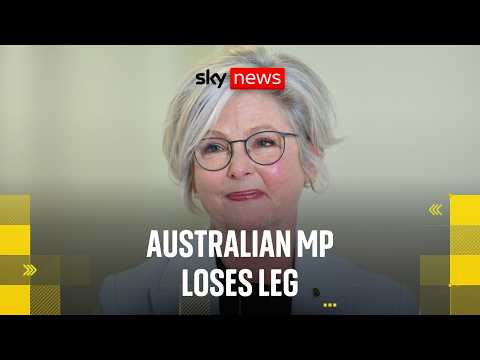 BREAKING: Australian MP loses leg after car ‘reversed to hit her a second time’