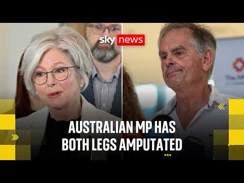BREAKING: Australian MP hit by a car has both legs amputated