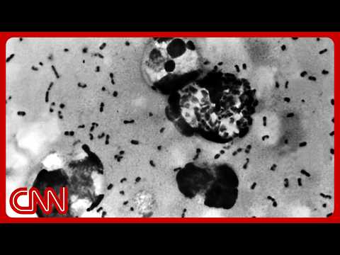 ‘Very concerned’: Doctors flag lack of transparency in Russian lab death